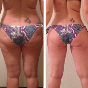 antes-e-depois-treino-ninja-31