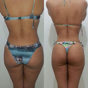 antes-e-depois-treino-ninja-34