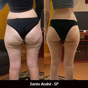 antes-e-depois-treino-ninja-4